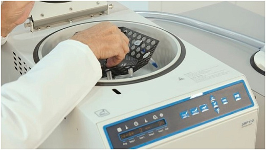 Установка ротора