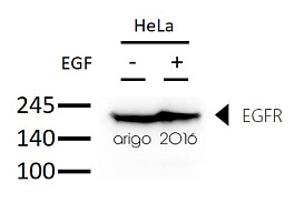 Вестерн-блоттинг: 30 мкг суспензии клеток HeLa, необработанные или обработанные EGF и окрашенные антителами anti-EGFR antibody в разведении 1:1000.