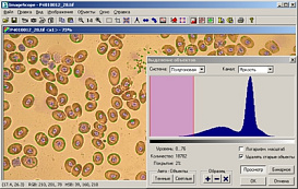 ПО для анализа изображений ImageScope, СМА