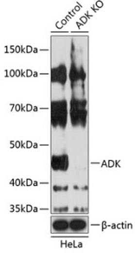 Антитела [KO Validated] ADK кроличьи, поликлональные