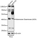 Антитела [KO Validated] Adenosine Deaminase (ADA) кроличьи, поликлональные