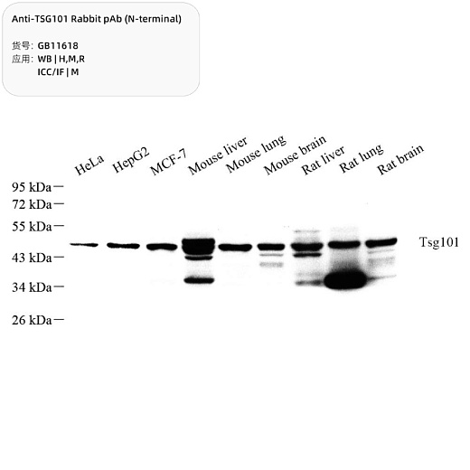 Антитела Anti-TSG101 Rabbit pAb, кроличьи, Servicebio