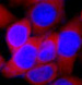 Вестерн-блоттинг: 20 мкг лизатов клеток HeLa и 3T3, окрашенных антителами anti-Bax antibody в разведении 1:3000.